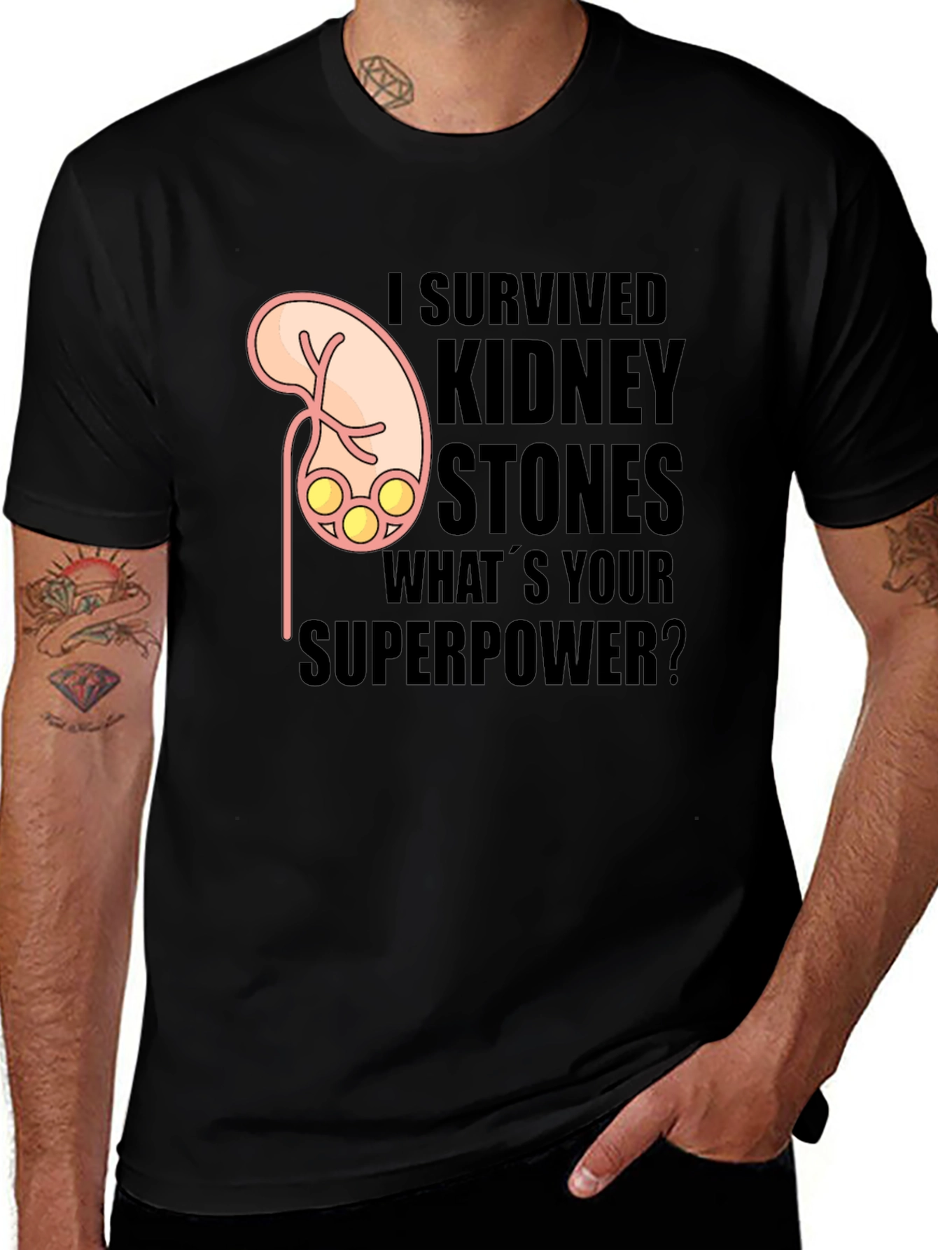 I Survived Kidney Stones Graphic T-Shirt